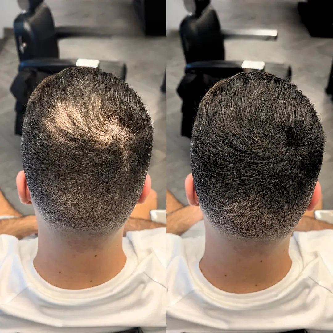 Apex Hair® - Pó Capilar que Cobre Calvície e Falhas na Hora | Acabamento Natural